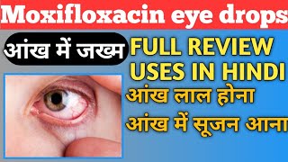 Moxifloxacin Eye Drops Hindi  Moxifloxacin And Dexamethasone Eye Drops [upl. by Amein]