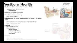 👂 Vestibular Neuritis  Presentation Pathophysiology Diagnosis amp Treatment [upl. by Ivah]