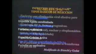 51 Semiología Médica de Lasala Hepatopatía Crónica 34 Caso clínico [upl. by Niasuh365]