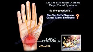 Patient Self Diagnose Carpal Tunnel Syndrome  Everything You Need To Know  Dr Nabil Ebraheim [upl. by Hadeehuat]