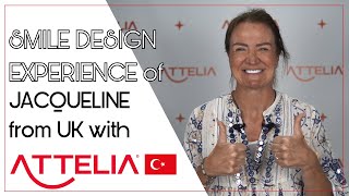 JACQUELINES SMILE DESIGN EXPERIENCE WITH ATTELIA DENTAL [upl. by Maximilianus]