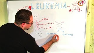 سرطانات الدم leukemia AML ALL CLL CML blast cells [upl. by Ennaid]