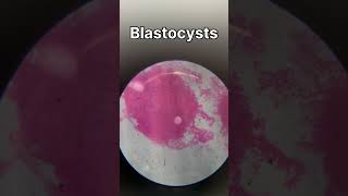 TS of ovary  TS of testis  ringworm bacteria under microscope biology animalkingdomclass11 [upl. by Merrile]