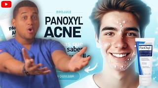 PanOxyl ACNE  3 Cosas Antes de Usarlo ¡ALERTA [upl. by Melbourne]