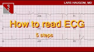 How to read ECG [upl. by Ennaecarg448]