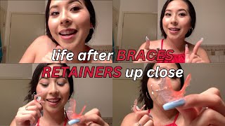 Life After Braces Wearing RETAINERS update  vlog [upl. by Enilada]