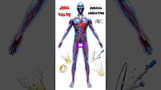 JenaValve short medical 3d animation Biology with Aliya [upl. by Sherlock]