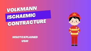 Volkmann Ischaemic Contracture  VIC [upl. by Ellah511]