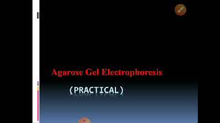 Agarose gel electrophoresis  practical [upl. by Belier]