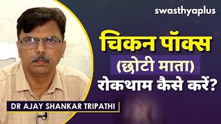 चिकन पॉक्स की रोकथाम कैसे करें  Symptoms of Chickenpox in Hindi  Dr Ajay Shankar Tripathi [upl. by Hausner]