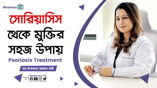 সোরিয়াসিস থেকে মুক্তির সহজ উপায়  Psoriasis Treatment  Dr Farzana Rahman Shathi [upl. by Nylodam148]