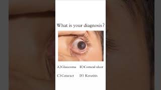 बताओ क्या है ये  MEDICAL  PARAMEDICAL  DIAGNOSIS  eye diagnosis medical study shorts [upl. by Toulon]