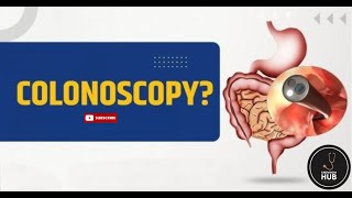 Colonoscopy Procedure Explained  What to Expect amp How to Prepare  Knowhow Hub [upl. by Aural]