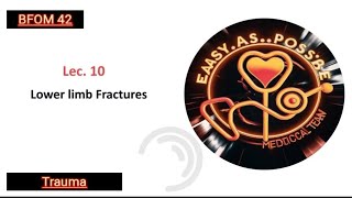 Lecture 10  Lower Limb Fractures  Trauma 42 [upl. by Odlaniger509]