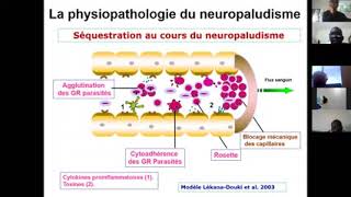 Intervention du Professeur Dapa Diallo drépanocytose et paludisme lors du 4e webinaire de Drépavie [upl. by Darnok]