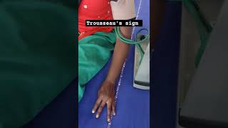 Trousseaus sign in latent tetany hypocalcemia [upl. by Hussar805]