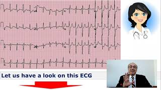 EKG Trainer Case 10 Questions [upl. by Nadirehs]