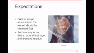 WoundRounds Webinar  Wound Assessment amp Documentation A Practical Guide [upl. by Rhpotsirhc]