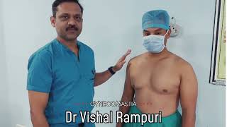 Gynecomastia का सही इलाज EXERCISE या SURGERY [upl. by Nahtal]