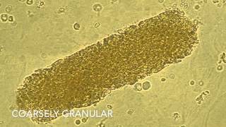 Análisis de Sedimentos en Orina UPRRCM Tecnología Médica 2016 [upl. by Nwahsd103]