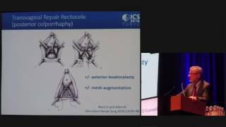 Rectocele Repair  Ronan OConnell  ICS 2016 Tokyo [upl. by Akiram107]