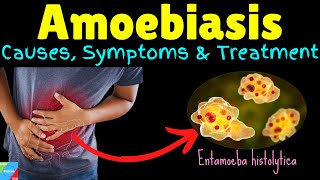 Amoebiasis  Amebiasis  Amoebic Dysentery – Symptoms Causes Treatment Complications Preventions [upl. by Agrippina]