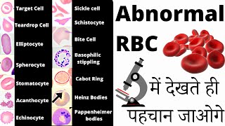 RBC Anomalies  RBC Abnormal Morphology  Inclusion bodies under microscope 🔬 [upl. by Portia]