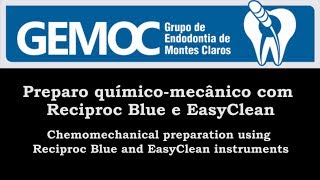 Preparo químicomecânico com Reciproc Blue e EasyClean [upl. by Durston64]