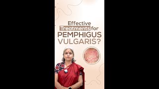 Effective Treatments for Pemphigus Vulgaris [upl. by Riek4]