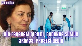 Bir fəqərəm qırıldı bədəndə sümük əriməsi prosesi gedir [upl. by Nairrad]