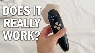 Depsoul Cellulite Massager Review  Does It Really Work [upl. by Burrow650]