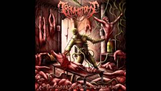 Traumatomy  Transformation Into A Putrid Mass 2013 FullEP [upl. by Niwrad]