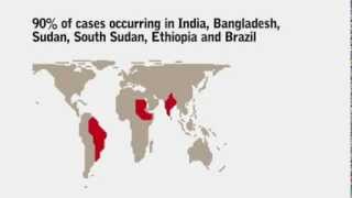 What do you know about Visceral Leishmaniasis Kala Azar [upl. by Oiramat]