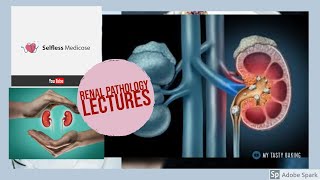 RENAL PATHOLOGY lecture 16 NEPHROSCLEROSIS [upl. by Oelgnaed]