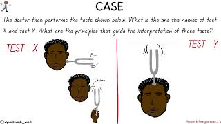 ENT CASE HEARING LOSS TUNING FORK TESTS AND PURE TONE AUDIOMETRY [upl. by Celene]