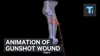 Animation of gunshot wound [upl. by Uhayile]