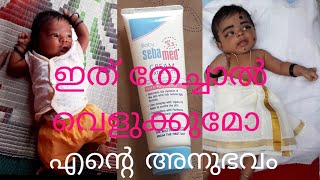 Sebamed cream honest review malayalam My experience [upl. by Blasien]