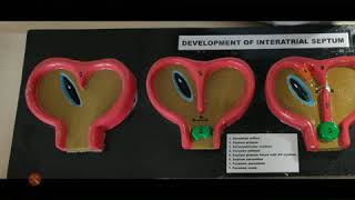 Development of interatrial septum exam model important [upl. by Alil393]