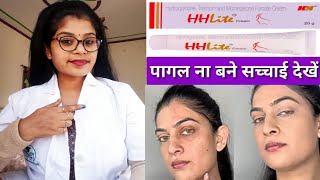 Skin Whitening HH Lite Skin Cream honest reviewHHLite cream benefits amp Sids effects review inhindi [upl. by Va]