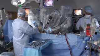 Laparoscopic vs Robotic [upl. by Candie]