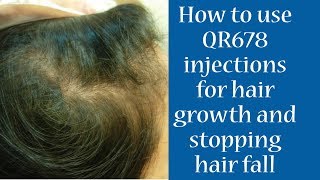 How To Use QR 678 Injection for Hair Growth amp Stopping Hair Fall  Dr Debraj Shome [upl. by Ellenahc]