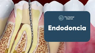 Salva un Diente de ser Extraído con una Endodoncia  The Dental District [upl. by Stout]