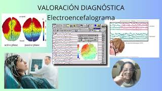 TC Resonancia magnética Electroencefalograma y punción lumbar  Función Neurológica 5 [upl. by Morse]