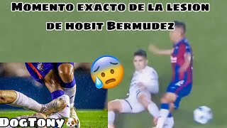 Lesión de quotHobbitquot Bermúdez hoy en el partido Atlante vs Dorados momento exacto [upl. by Sybila244]