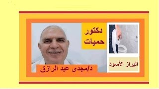 البراز الأسود ومكملات الحديد [upl. by Revorg]