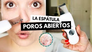 Pruebo la ESPÁTULA ULTRASÓNICA contra POROS ABIERTOS y sebo facial  Pretty and Olé [upl. by Otilegna]