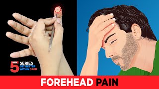 Headache  Sujok Treatment with Migraine Cluster Headache Acupressure Pain management🤕😓🔥 [upl. by Tyne]