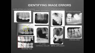 Image Evaluation for an FMX Identifying amp Correcting Errors [upl. by Prunella]