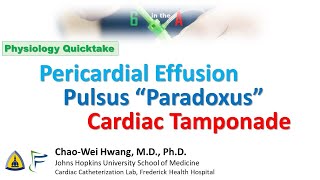 Pulsus Paradoxus Pericardial Effusion Cardiac Tamponade [upl. by Avlasor504]