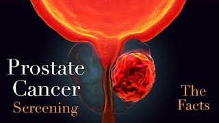 Prostate Cancer  Do You Need a PSA Test [upl. by Brandea806]